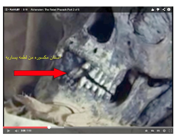 اسنان امون حوتوب الثالث فرعون موسي